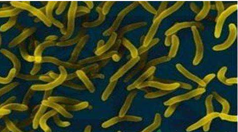 微生物菌劑好？好在哪里您知道嗎？